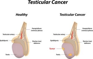 self examination of the testicles